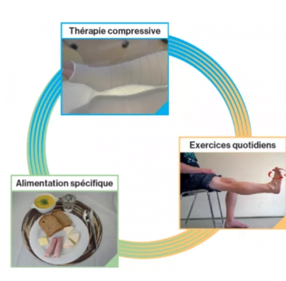 A pluridisciplinary venous leg ulcer education program