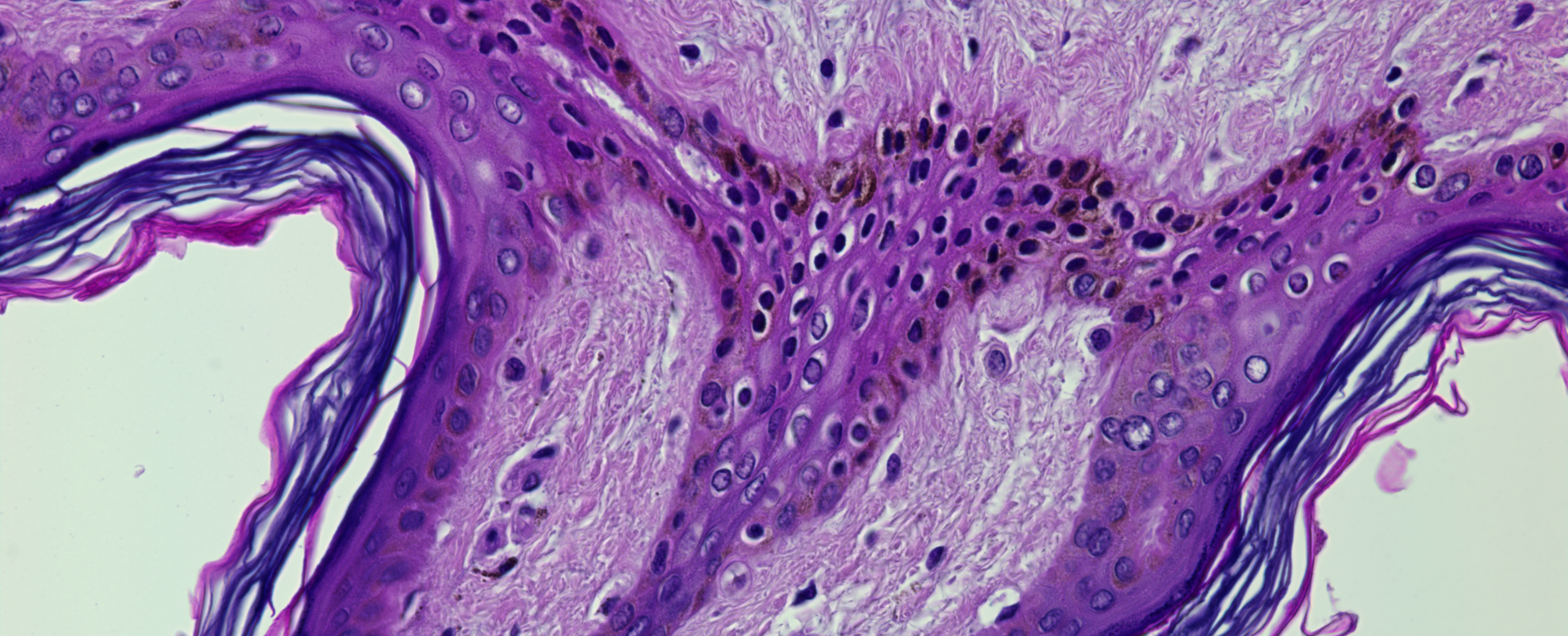 Epidermal tissues treated with Dly toxin