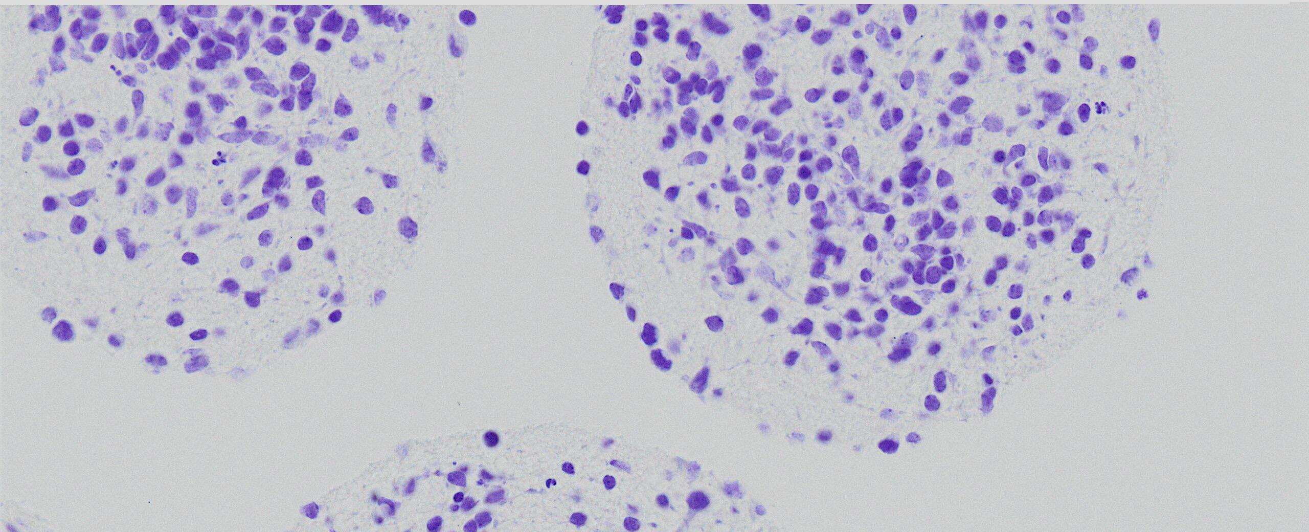 Histological section of «Mini-Brains»