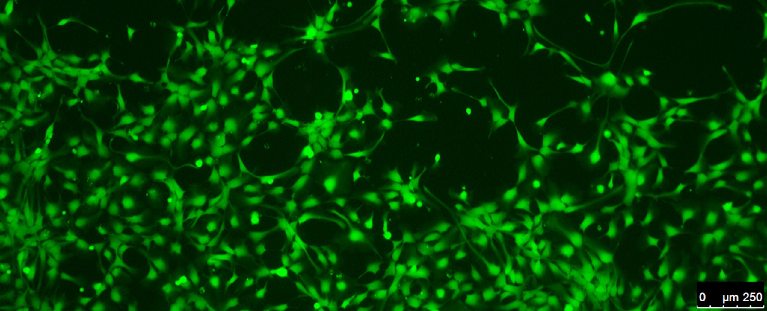 Marquage immunologique de neurones humains issus de cellules souches reprogrammées