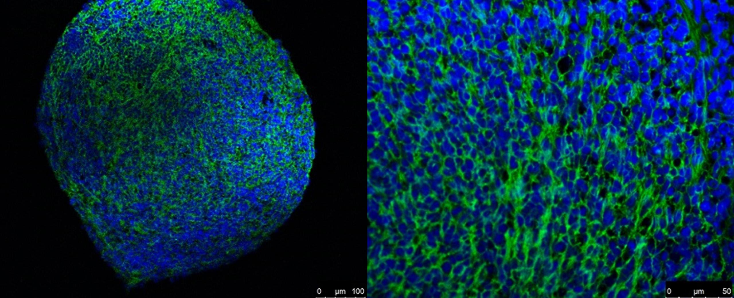 Marquage immunologique de «Mini-cerveaux»