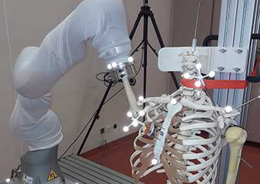 Projet RoboShoulder